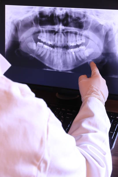 Best Emergency Root Canal Treatment in Glendale, OH